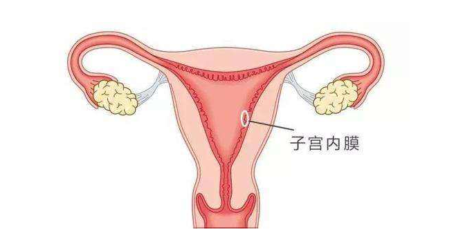 刮宫对上海试管婴儿移植有帮助吗