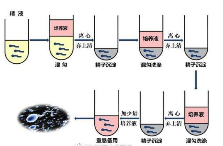 坤和精子洗涤术