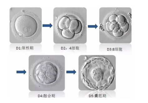 美国试管婴儿全部费用及详细流程概况