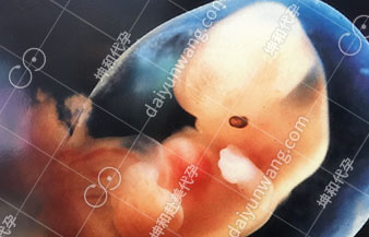 胚胎移植受形成型图片